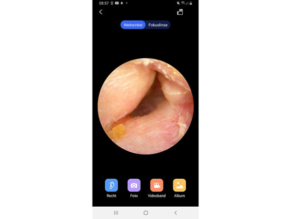 nettoyeur pour oreille avec pplication gratuite pour transmission en direct et enregistrement d'images et de vidéo sur smartphone et tablette