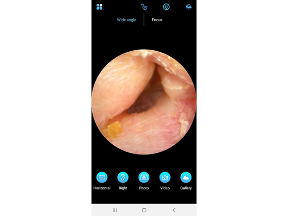 Nettoyeur d'oreille WOR-250. Application gratuite Android IOS.
