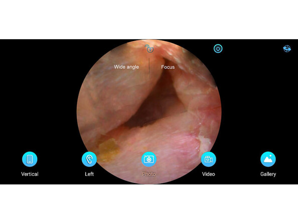 Nettoyeur d'oreille WOR-250. Vue Caméra Full HD. Avec angle de champ 70° .