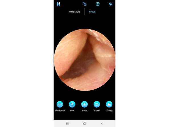 Nettoyeur d'oreille WOR-250. Vue Caméra Full HD.Capteur d'image : CMOS+, 5 Mpx