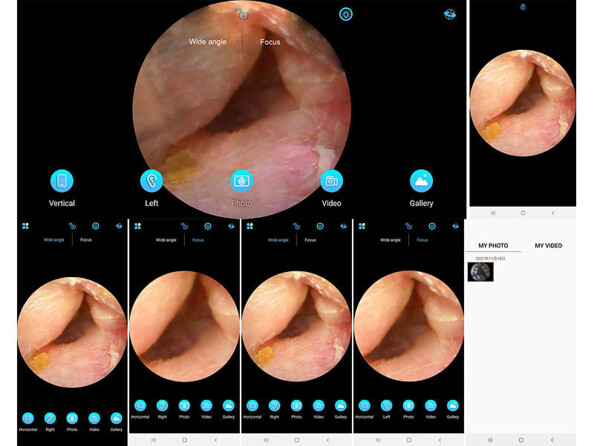 Nettoyeur d'oreille WOR-250. Vue Caméra Full HD. Avec angle de champ 70° .