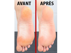 Râpe à pieds électrique 2 en 1 SB-30.bc