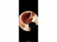 nettoyeur d’oreilles connecté